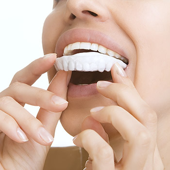 Patient completing at-home teeth whitening