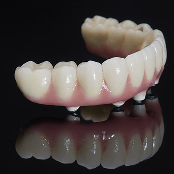 Implant denture prior to placement