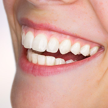 Closeup of healthy teeth and gums