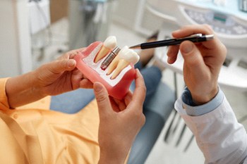 Dental patient holding model of dental implant