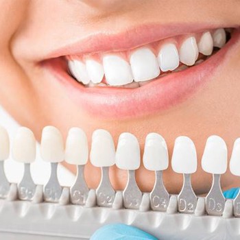 Dental crown color matching guide