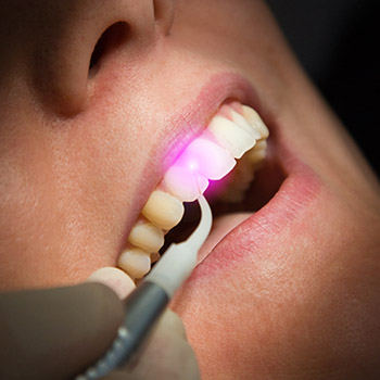 Closeup of patient receiving laser treatment