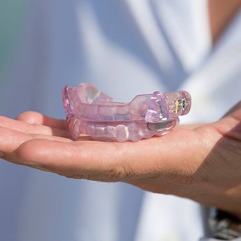 Hand holding a sleep apnea appliance