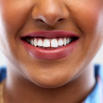 A woman with a small gap between her two front teeth