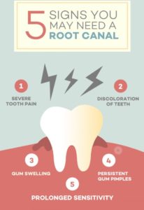 Root Canal Portage - 5 Signs
