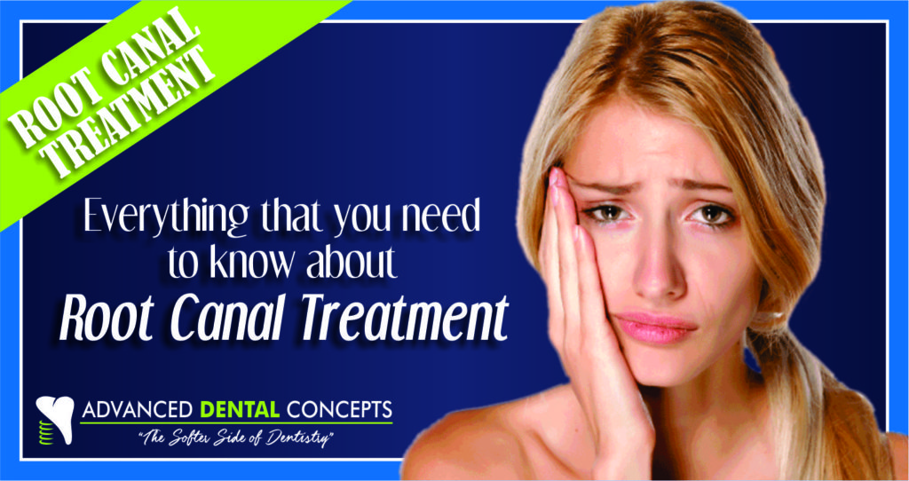 Root Canal Treatment, what you need to know.