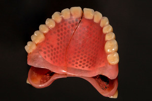 Close-up of a full denture broken down the middle